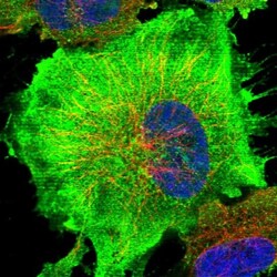 Complement Component C9 Antibody, Novus Biologicals 25 &mu;L; Unlabeled:Antibodies,